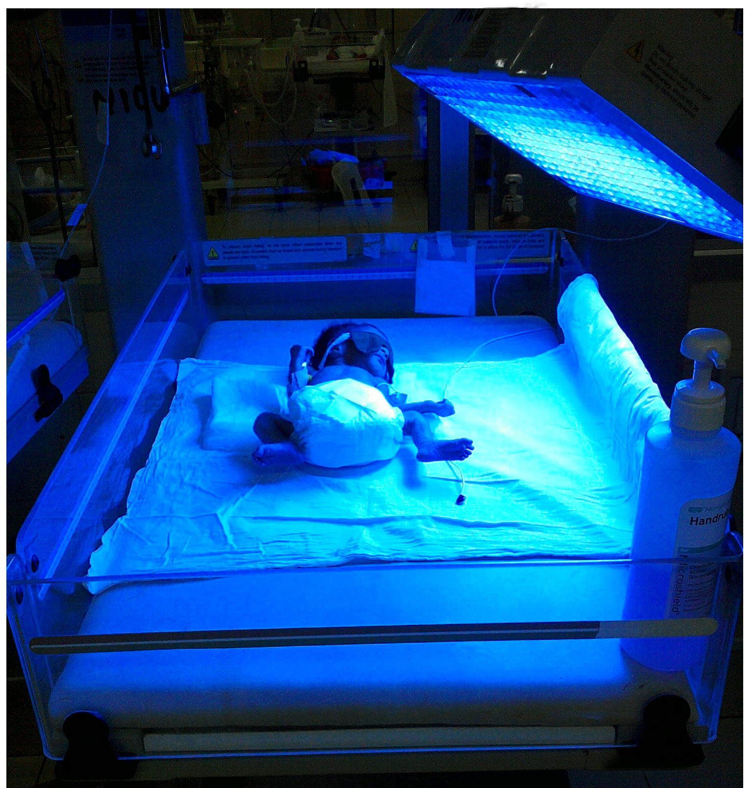 Photobiomodulation Neuroplasticity.how